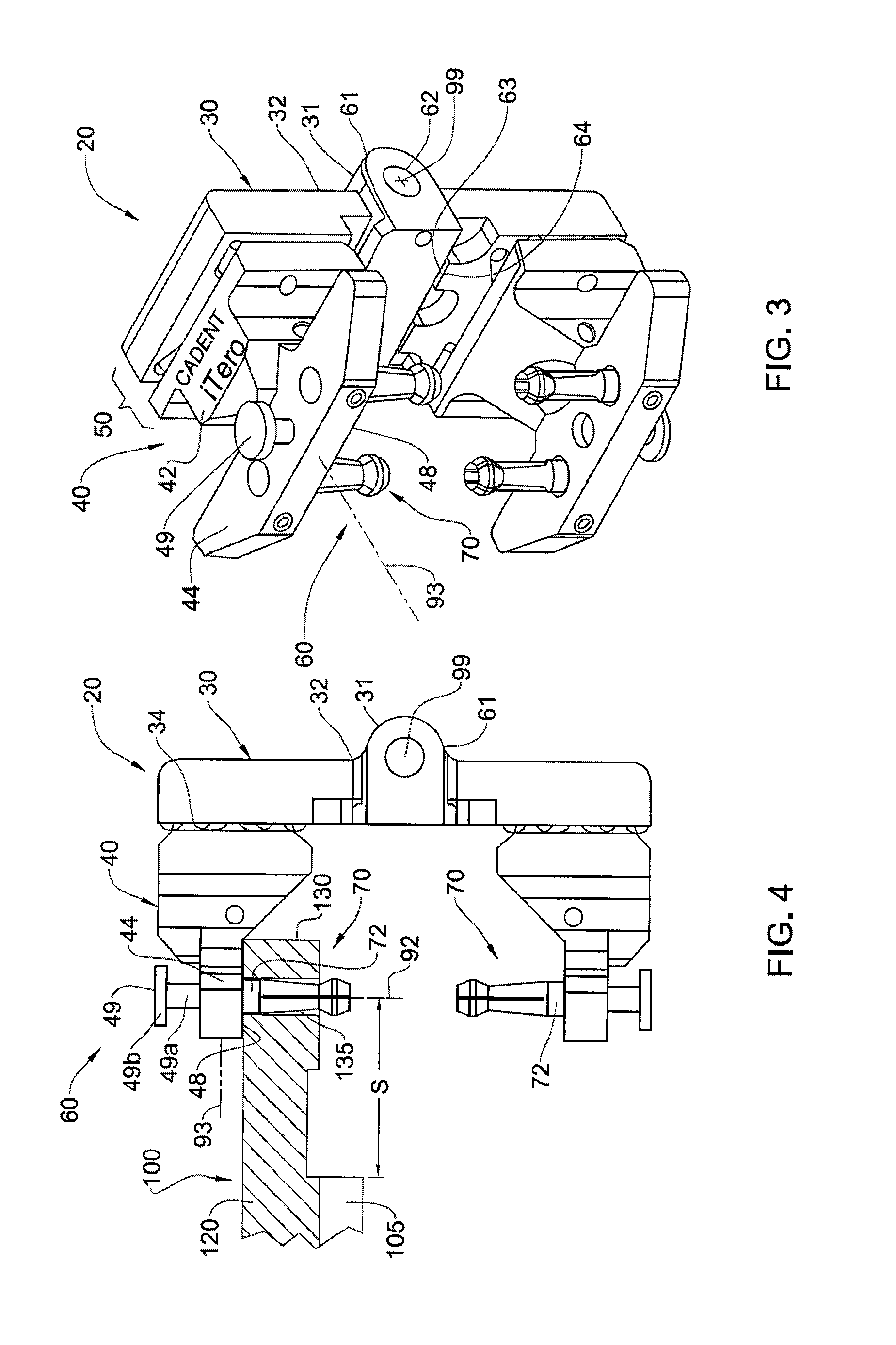 Dental articulator