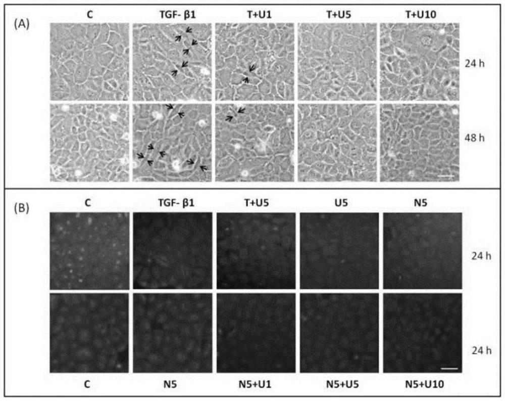 Application of DOR agonist in preparation of medicine for resisting renal fibrosis