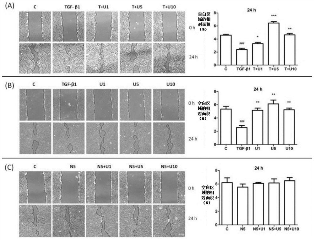 Application of DOR agonist in preparation of medicine for resisting renal fibrosis