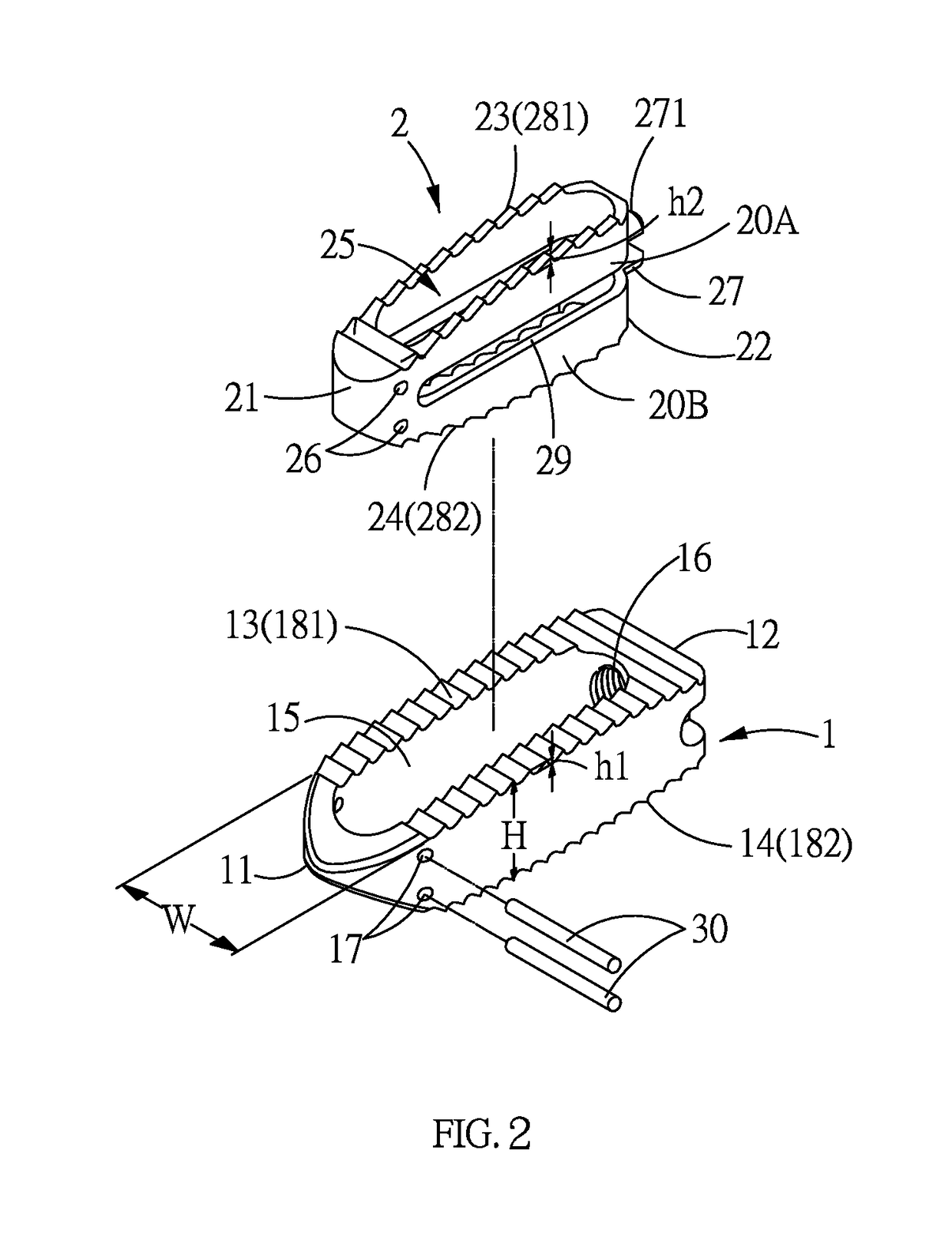 Bone fusion device