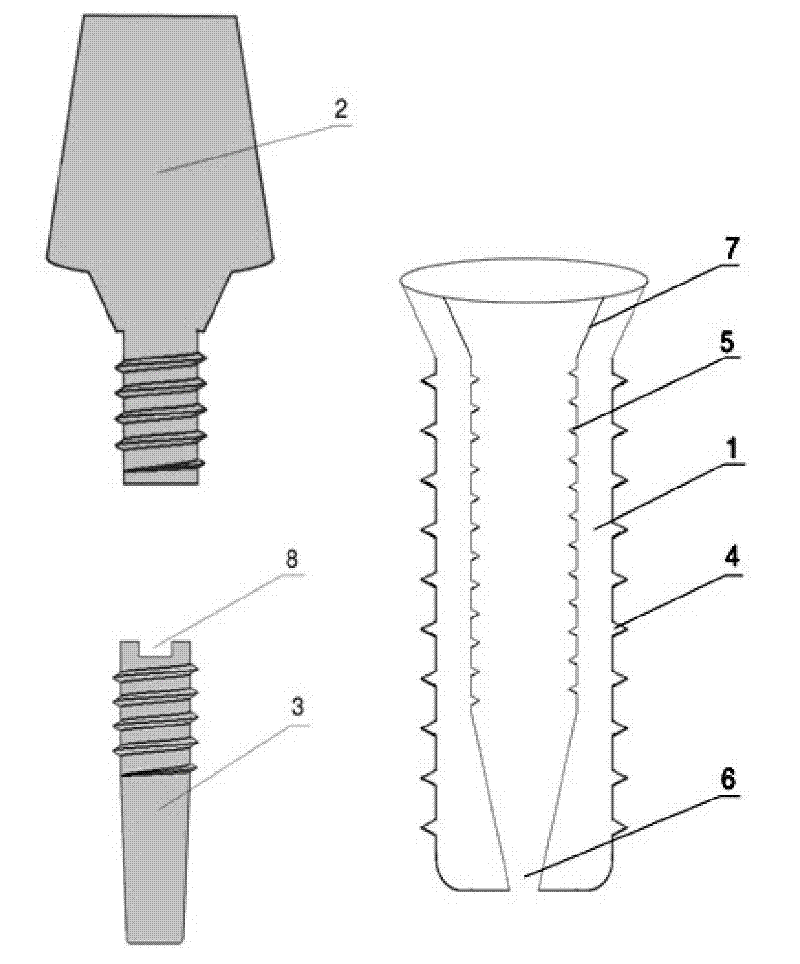 Expanded tooth implant