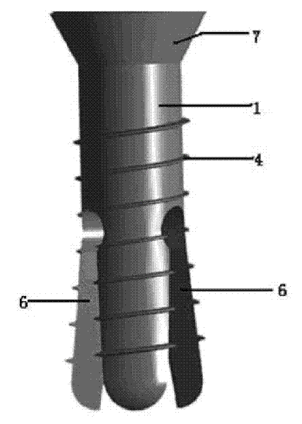 Expanded tooth implant