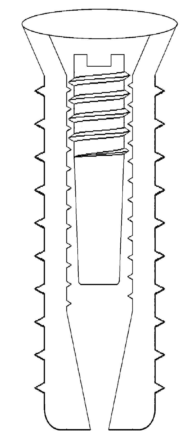 Expanded tooth implant