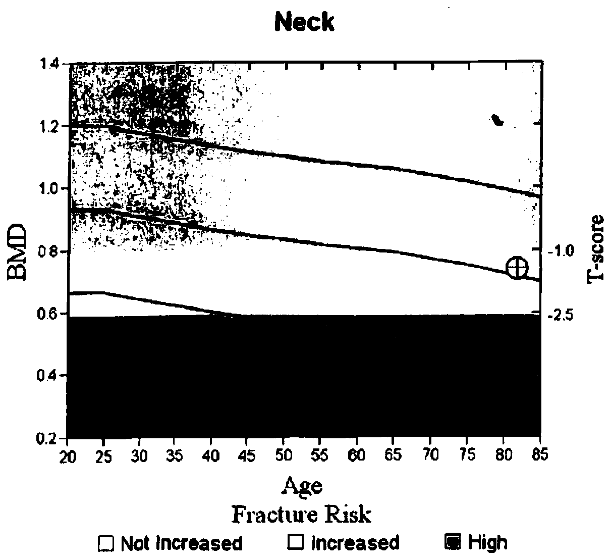 Traditional Chinese medicine for treating cramps and preparation method thereof