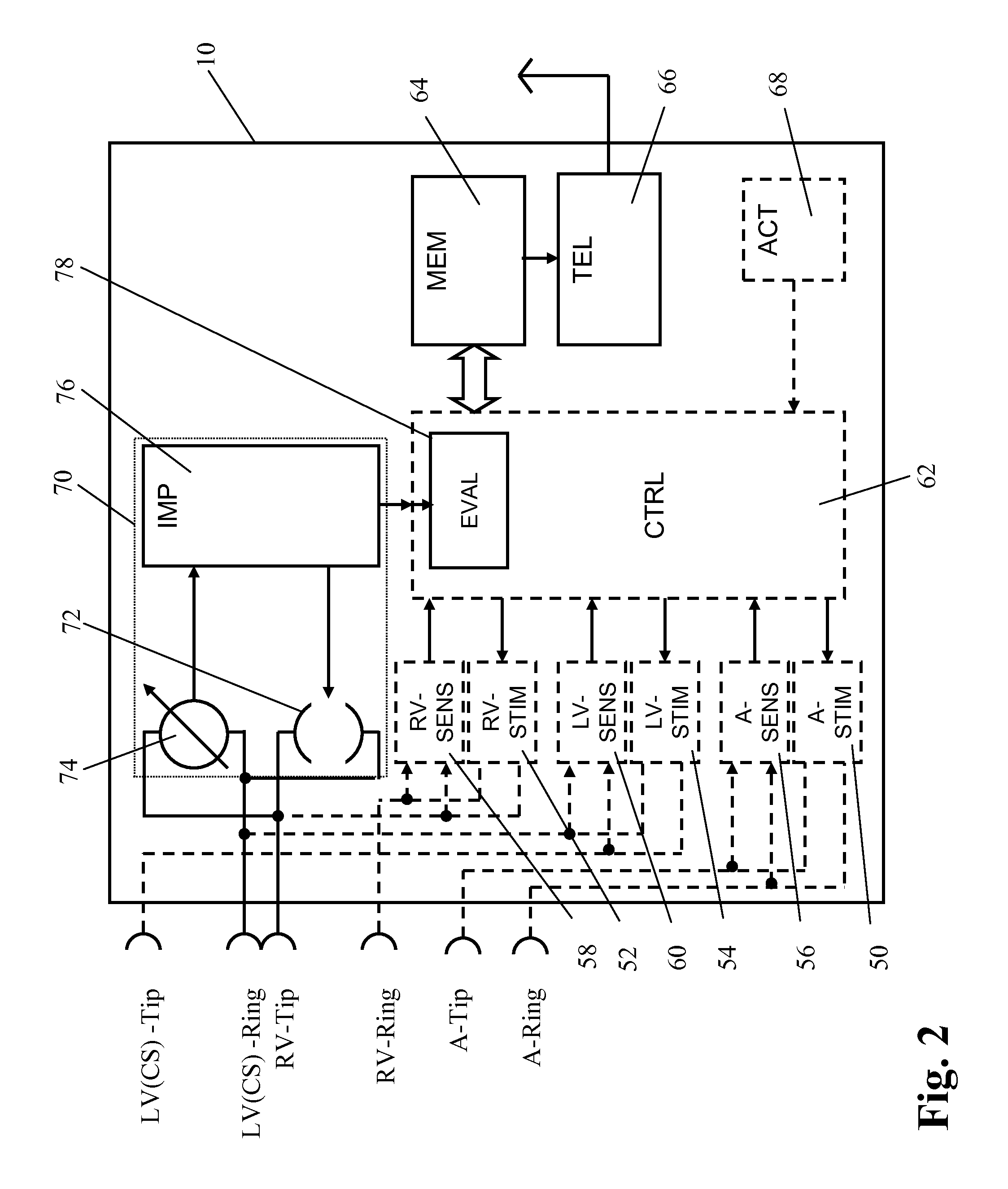 Apparatus and method to optimize pacing parameters