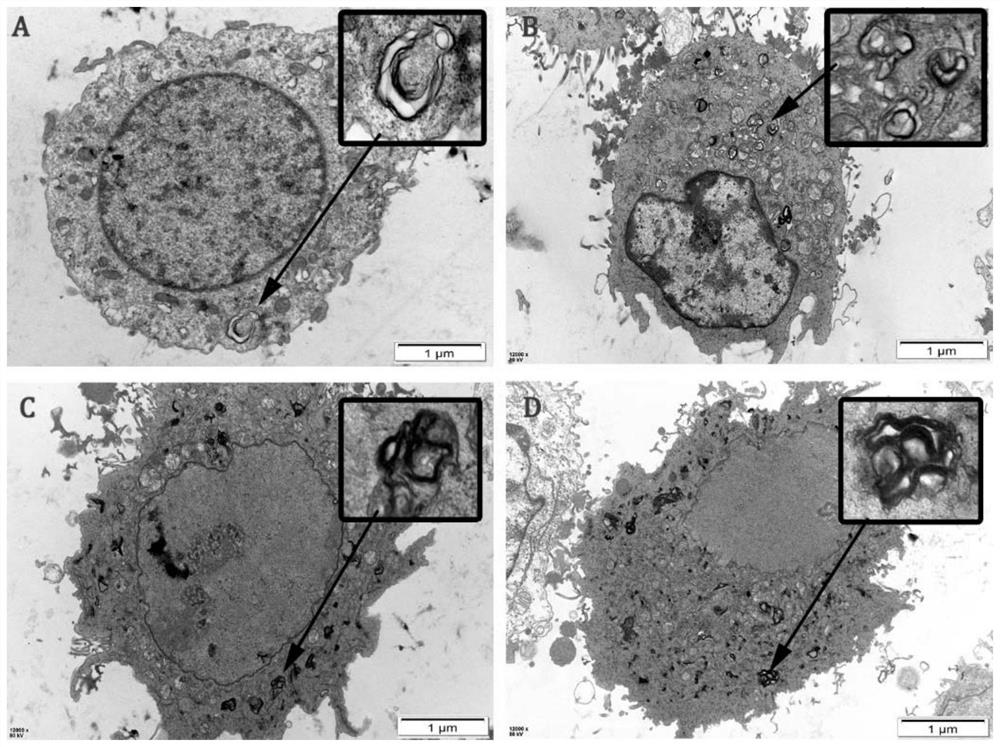 Purpose of curcumin or drug-loading system thereof in preparation of drug for treating penis erection dysfunction