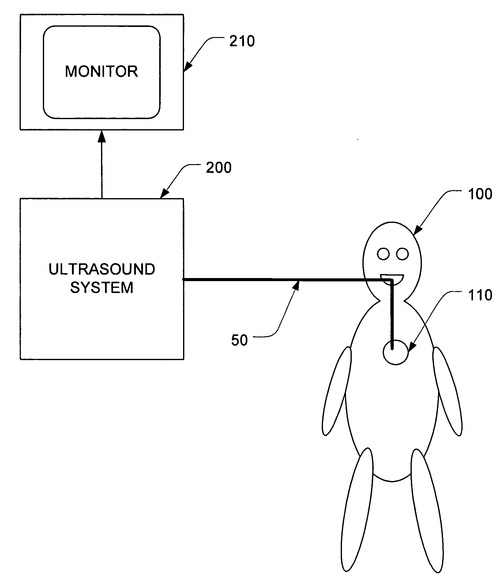 Transesophageal ultrasound using a narrow probe