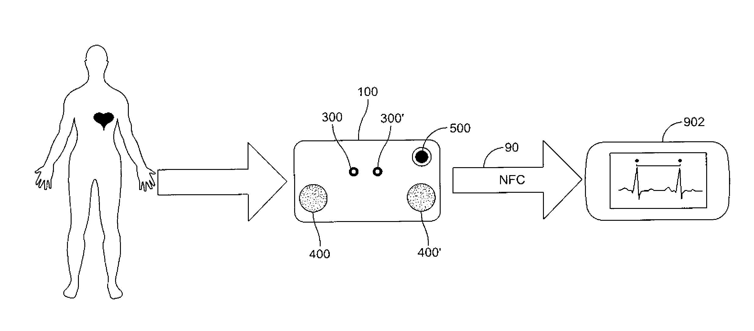 eCard ECG Monitor