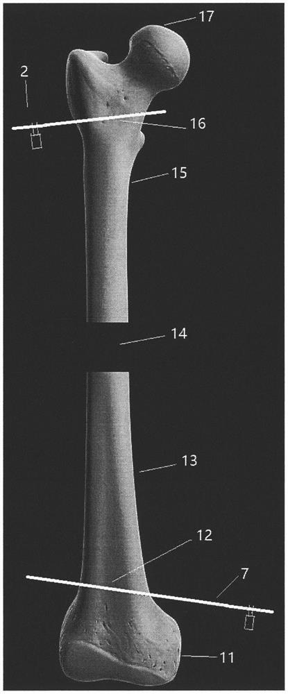 Method and device for monitoring fracture rotation alignment in real time with assistance of gyroscope