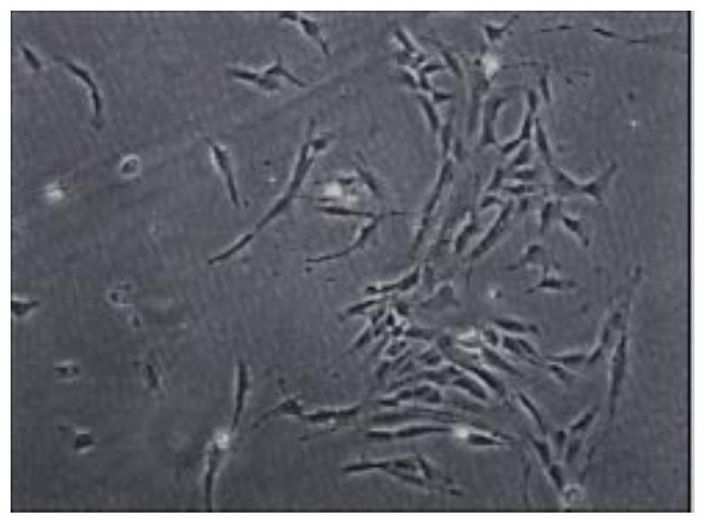 Stem cell cryopreservation method and cell cryopreservation solution used by stem cell cryopreservation method