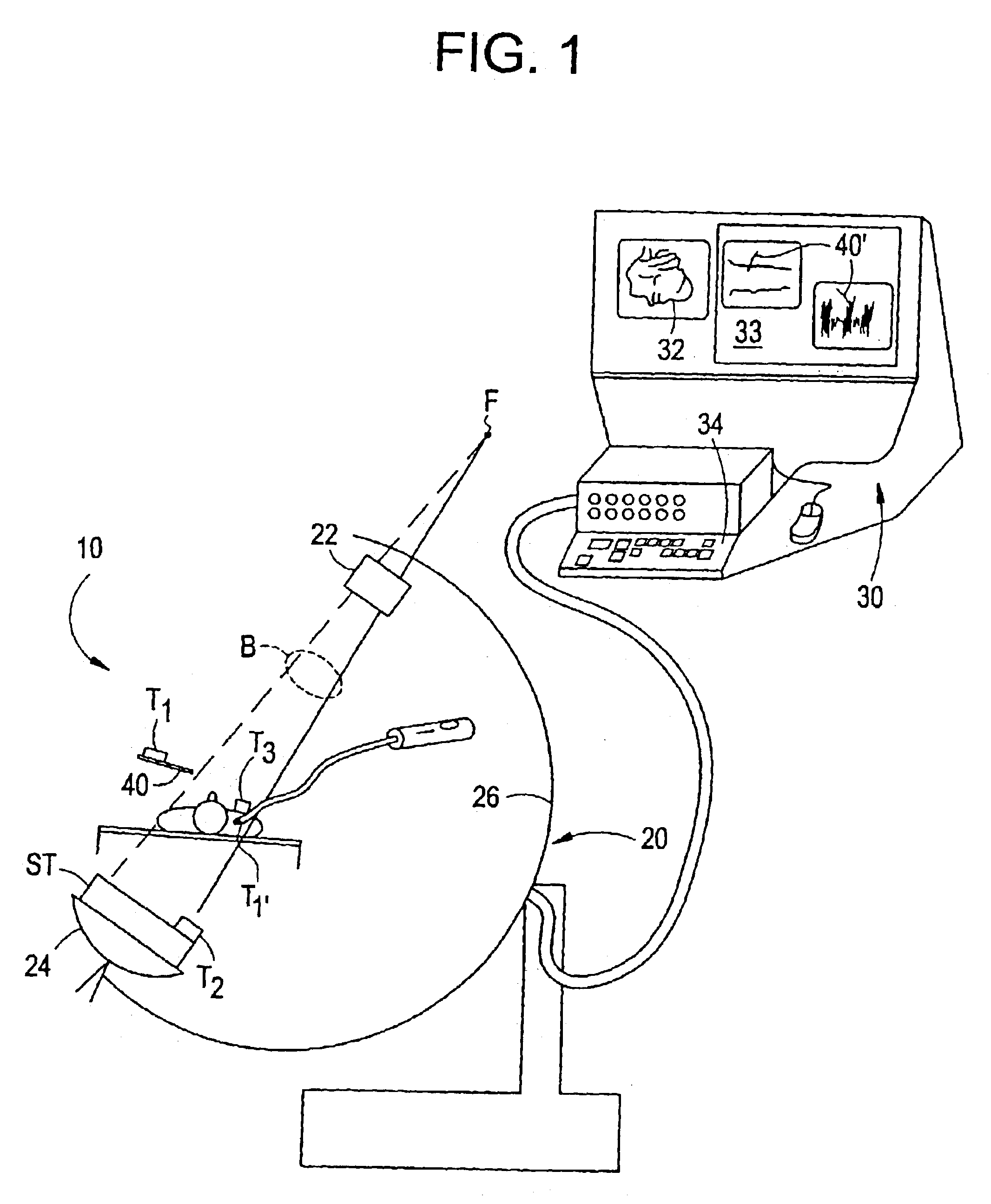 Fluoroscopic tracking and visualization system