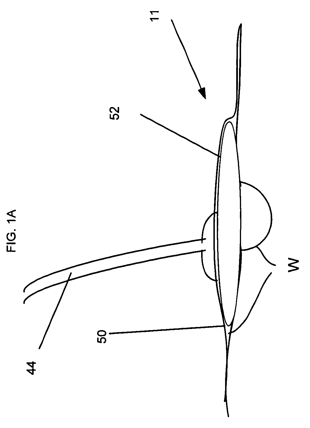 Method and device for providing intermittent negative pressure wound healing