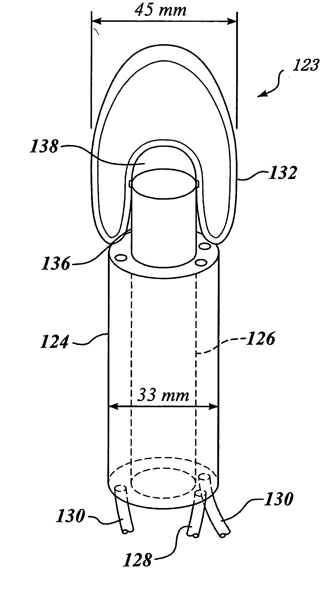 Image guided high intensity focused ultrasound device for therapy in obstetrics and gynecology