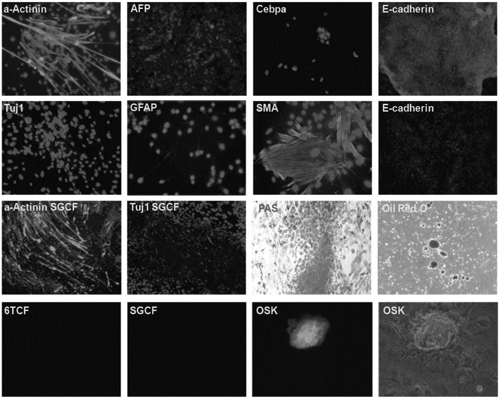 Inducing culture medium for inducing fibroblast to trans-differentiate into cardiac muscle cells and application of inducing culture medium