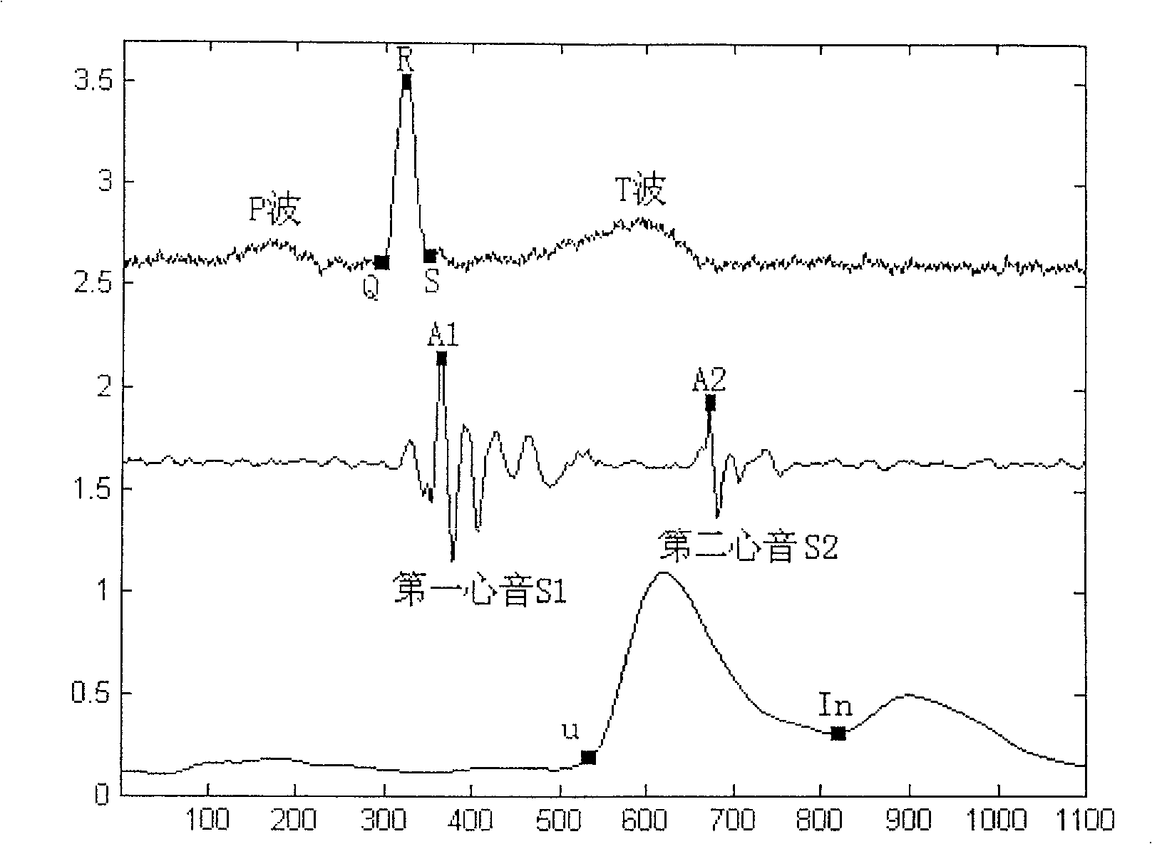 Detector methods and apparatus of cardiovascular system combining with variability guideline