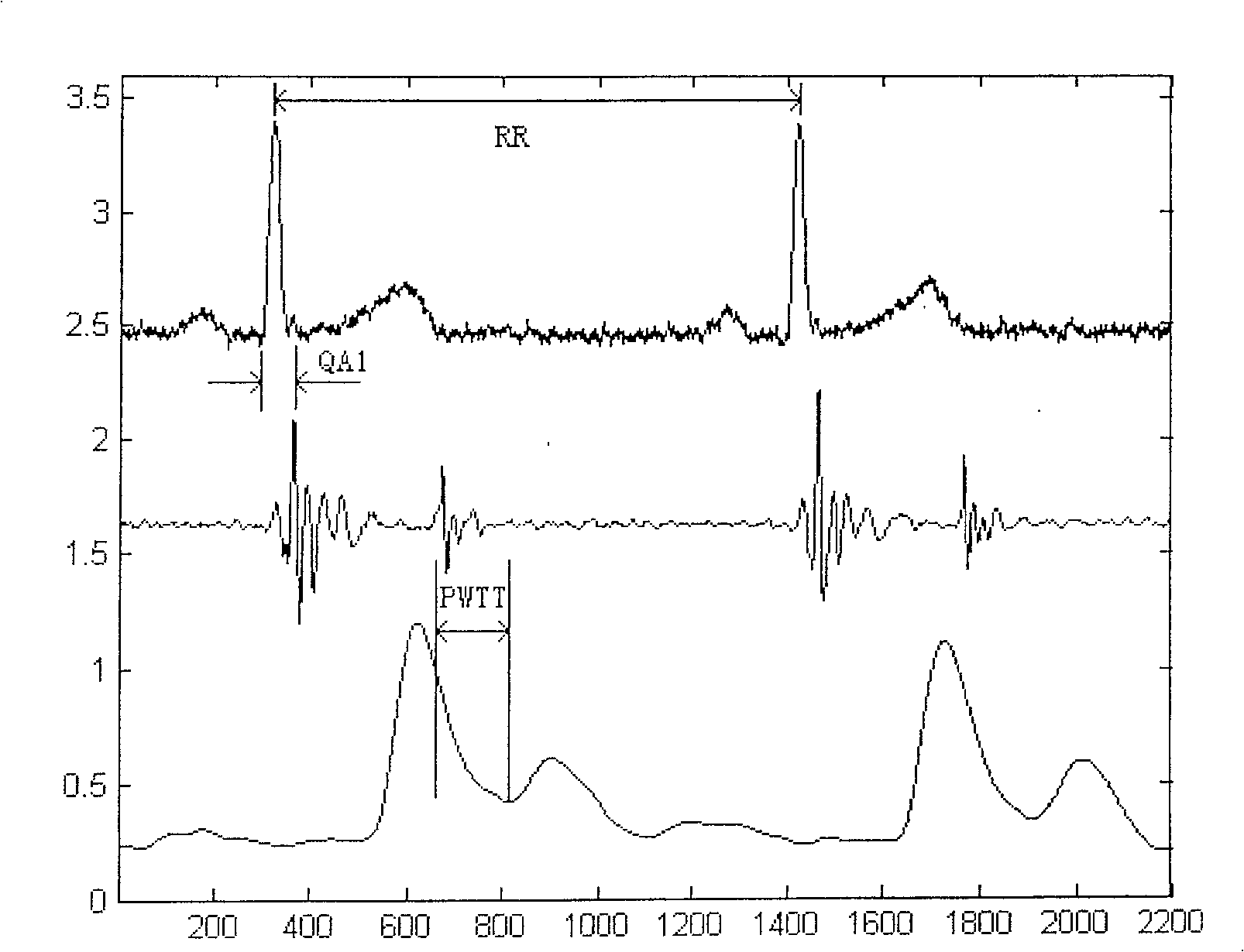 Detector methods and apparatus of cardiovascular system combining with variability guideline