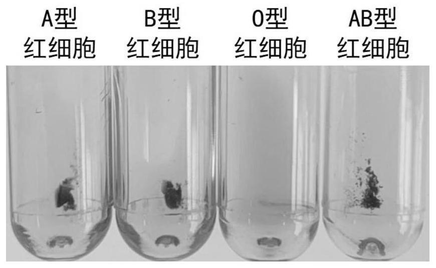 A kind of blood group antibody complex, preparation method