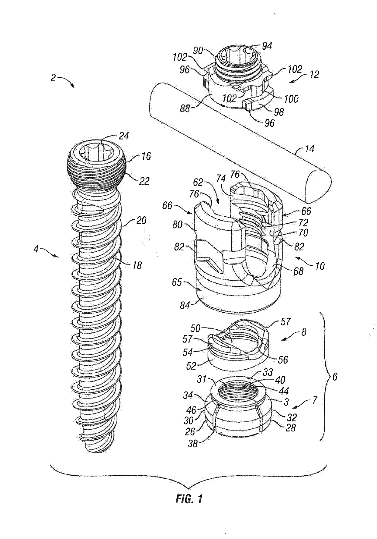 Orthopedic fixation devices and methods of installation thereof