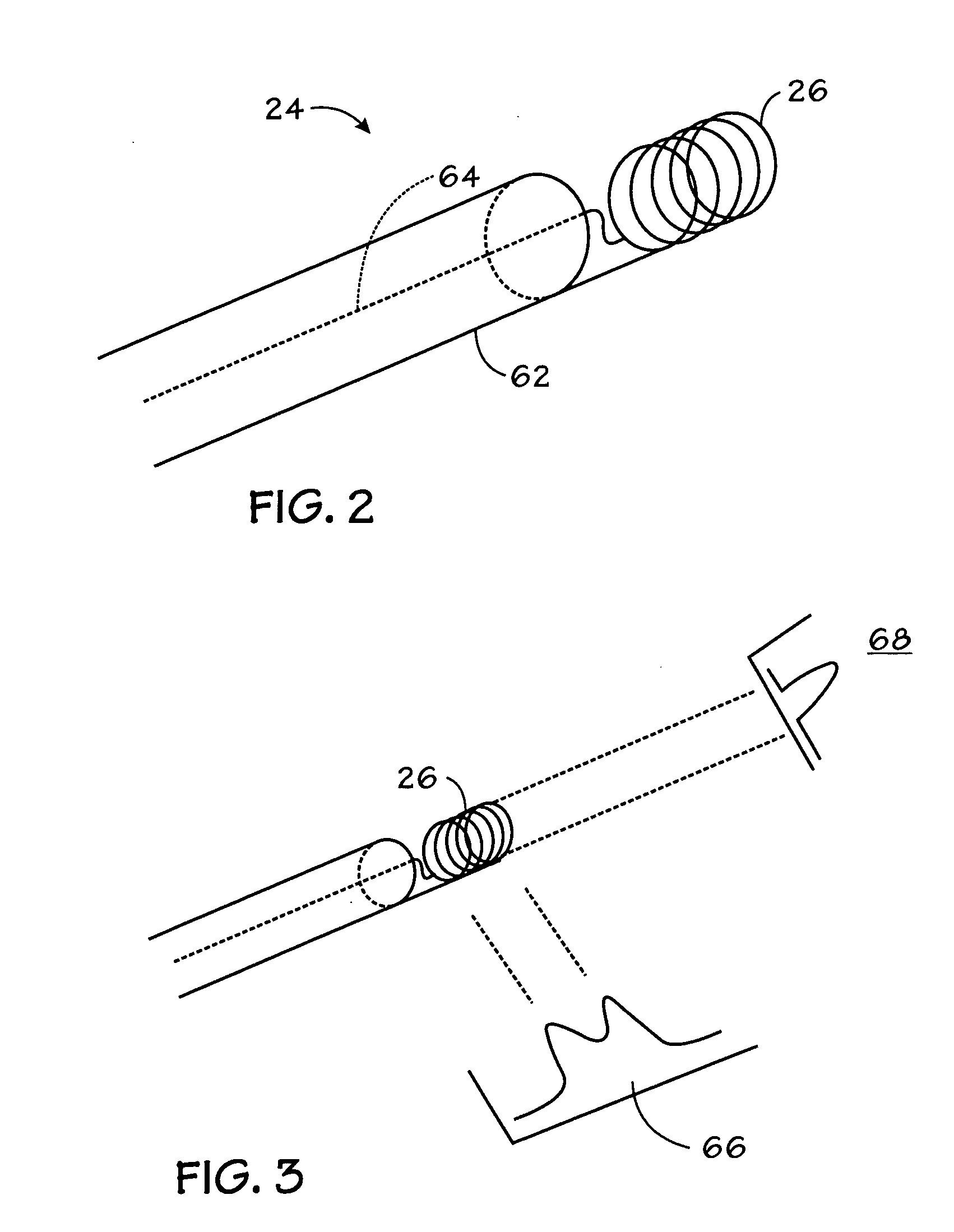 Method for multiplexed MR tracking