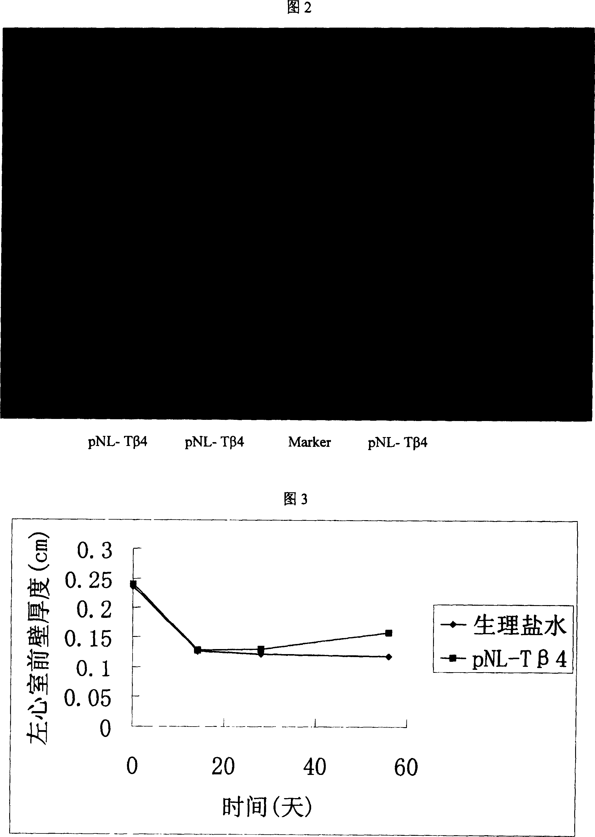 Recombinant plasmid with human thymosin Beta-4gene