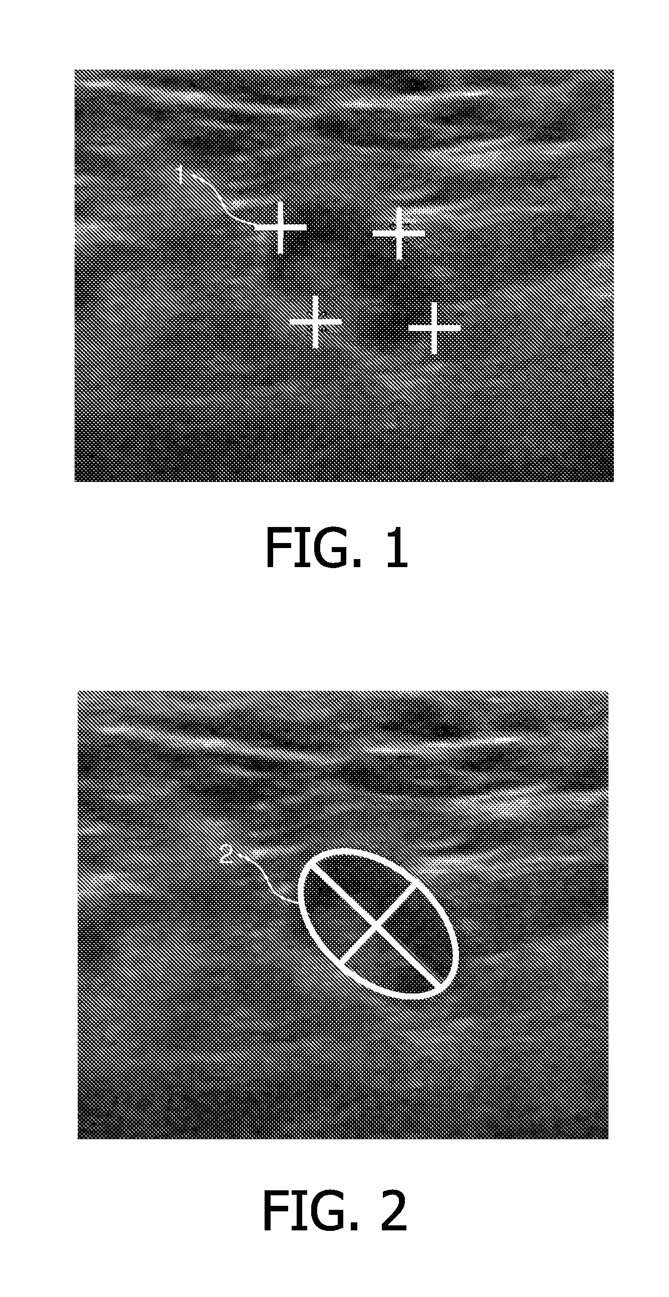 Selection of snapshots of a medical image sequence