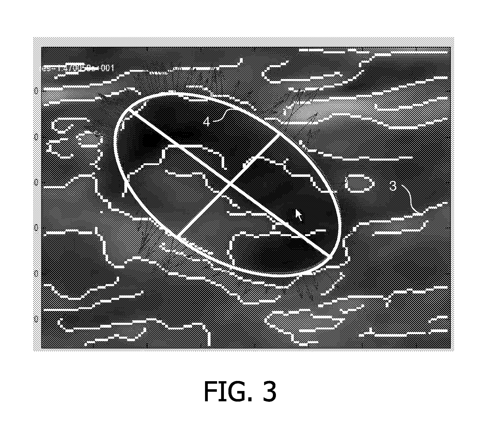 Selection of snapshots of a medical image sequence