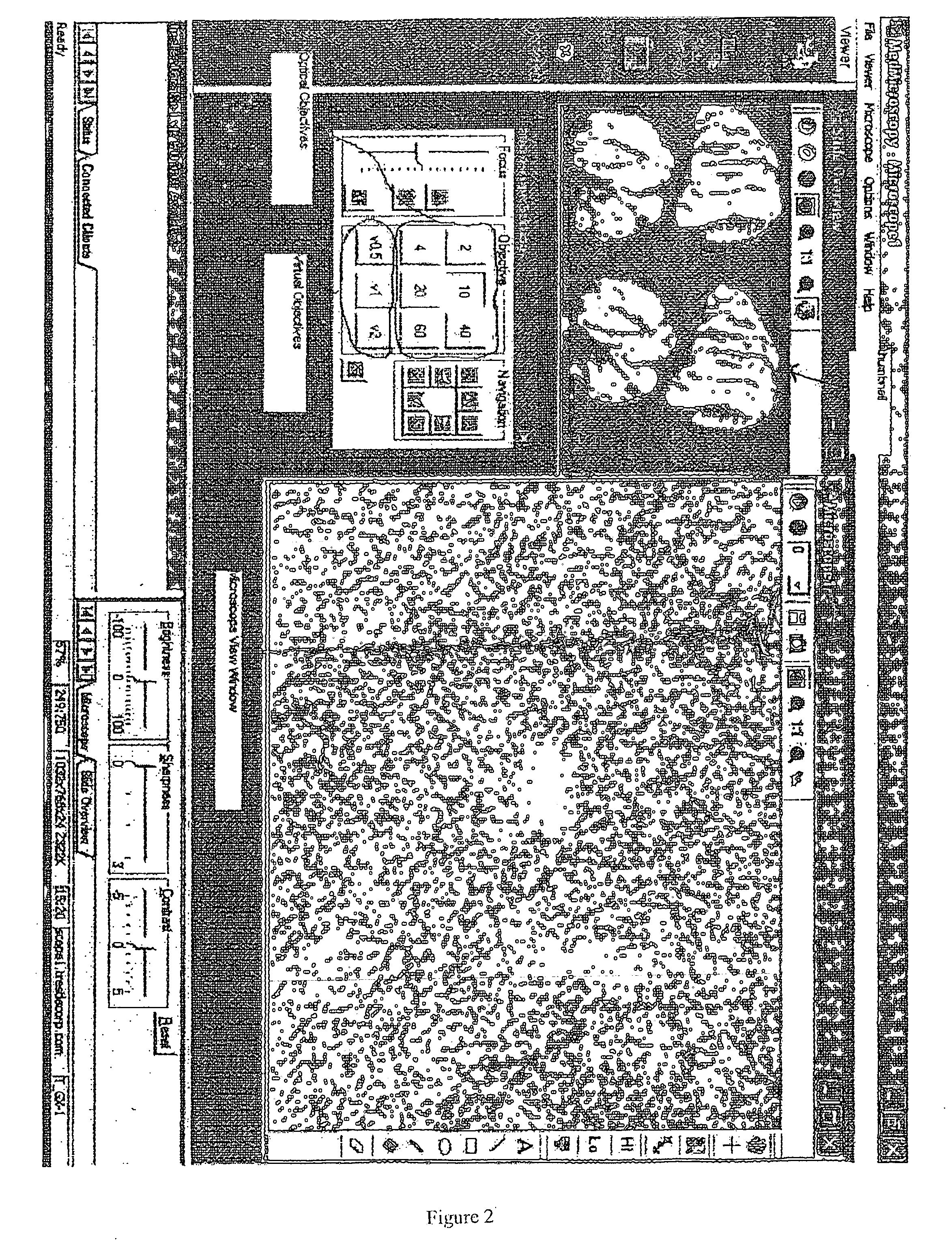 System for remote viewing and display of a slide