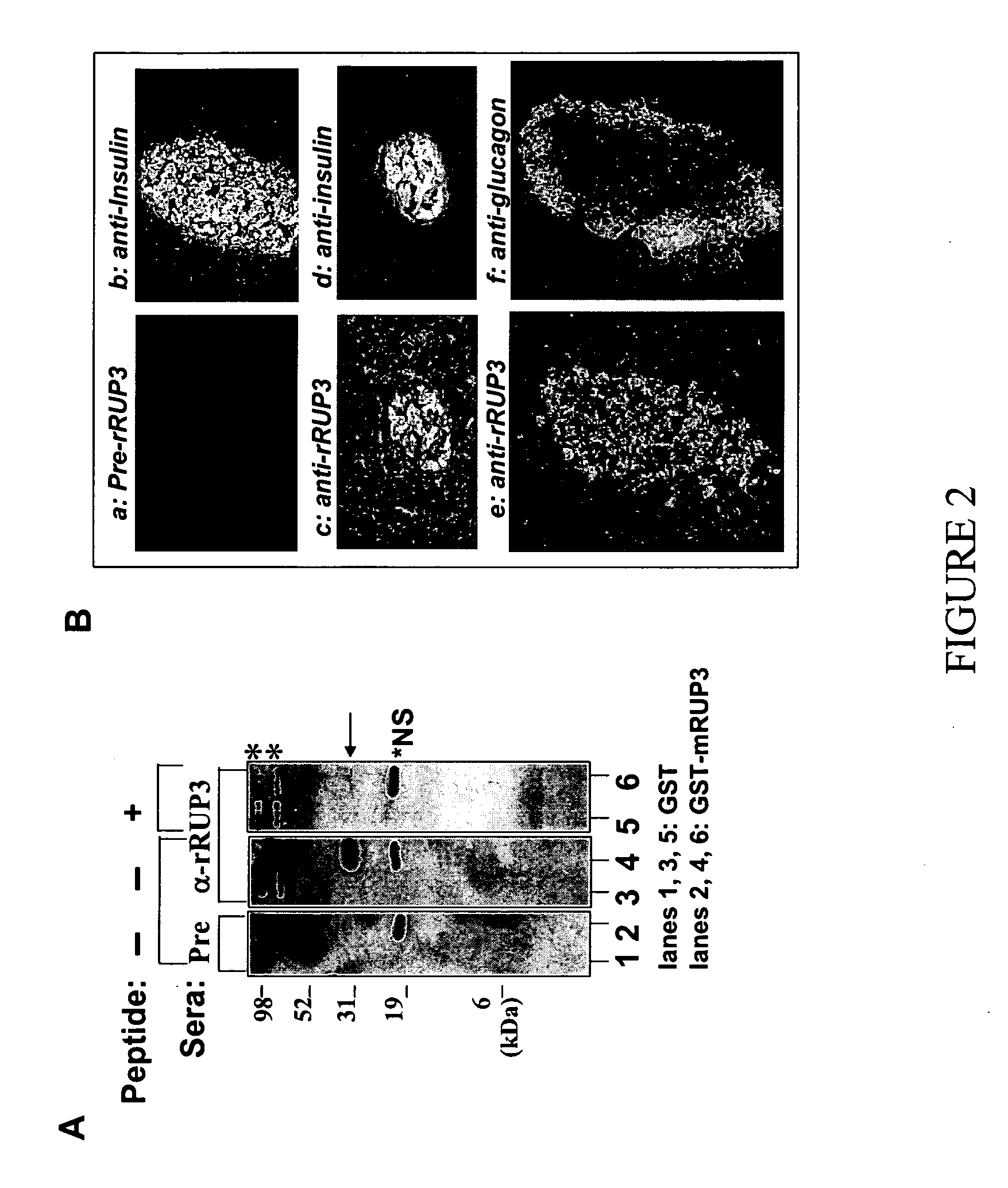 Substituted pyridinyl and pyrimidinyl derivatives as modulators of metabolism and the treatment of disorders related thereto