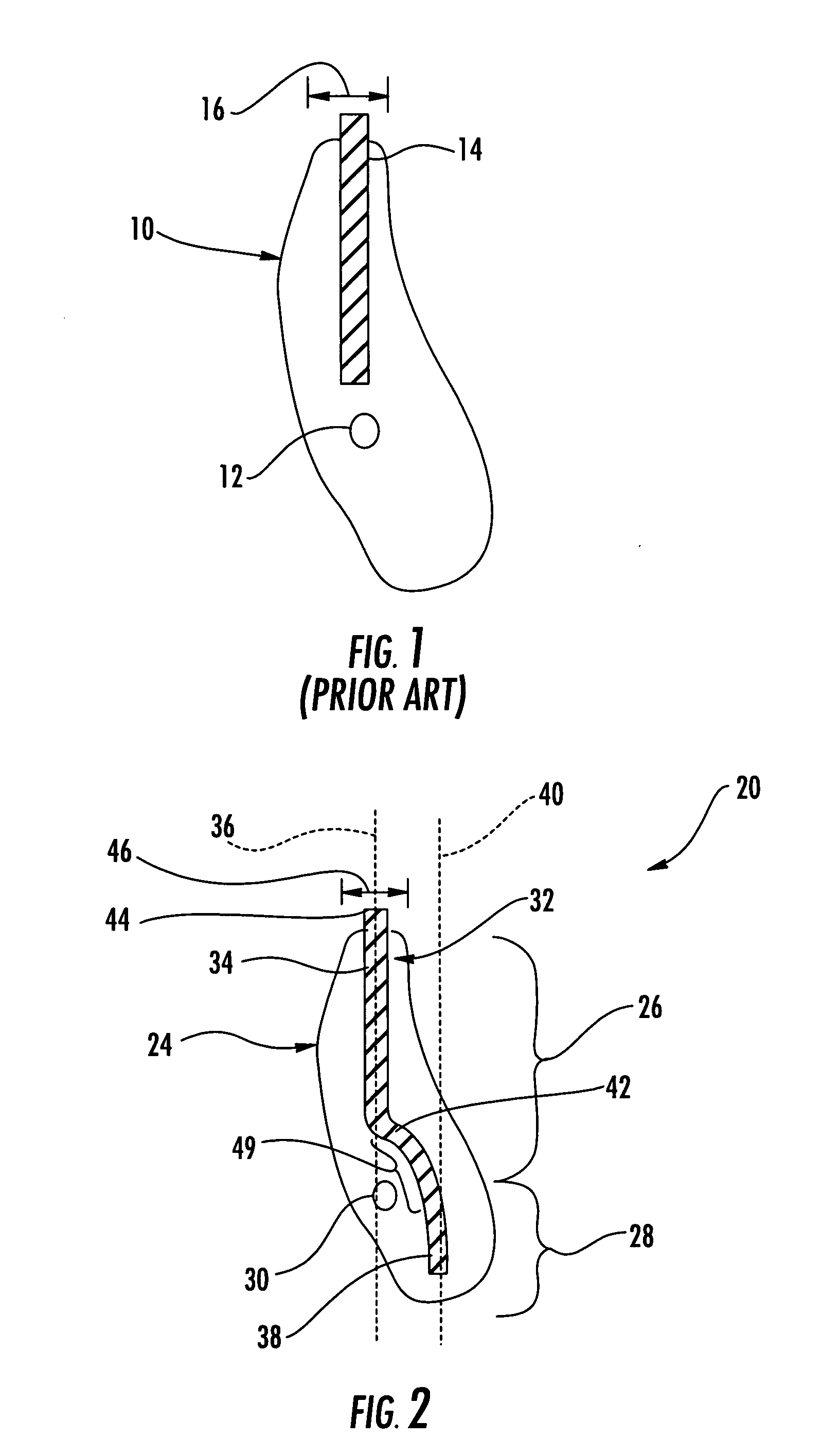 Dental fixture implantation system and associated method