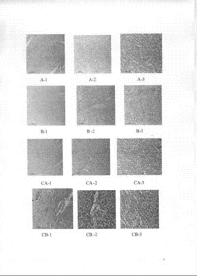 Application of composition of Chinese yarn polysaccharide and Chinese yarn protein