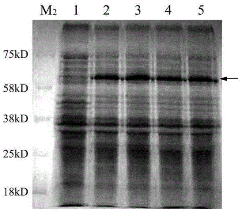 Application of kin17 gene or protein in preparation of medicament for diagnosis and treatment of cervical cancer