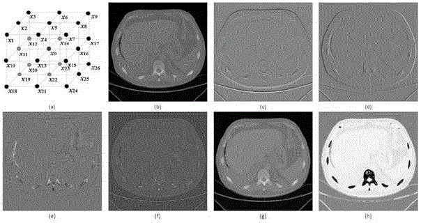 Removal method and system for bone tissue in 3D CT (Three Dimensional Computed Tomography) image