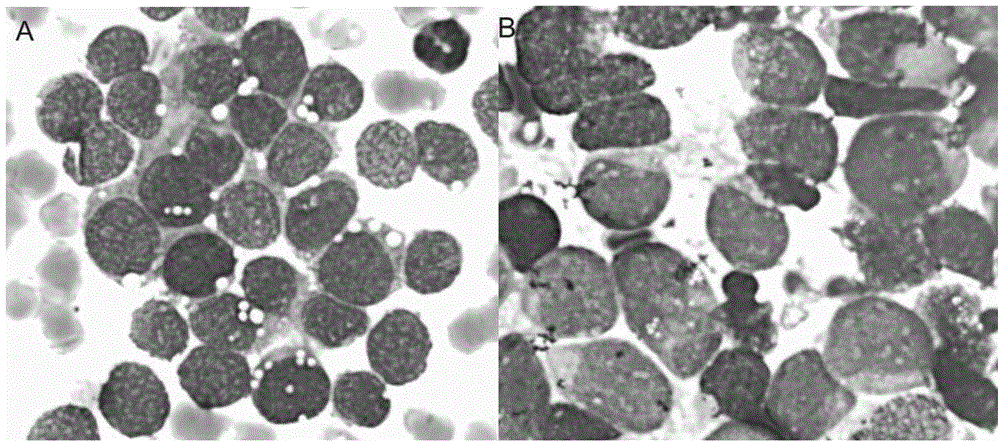 Fluorescent probes and kits for differential diagnosis of rhabdomyosarcoma and neuroblastoma bone marrow metastasis and leukemia by flow cytometry