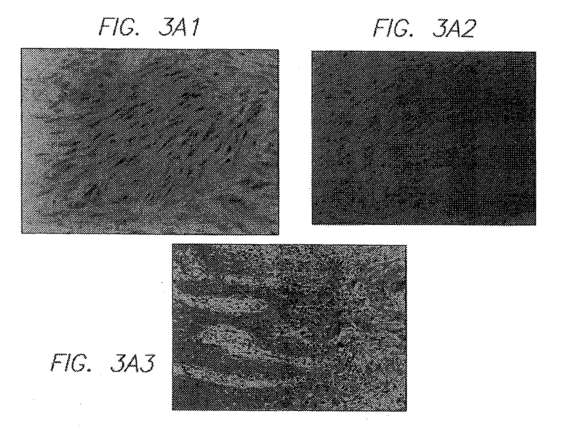 In vivo gene transfer methods for wound healing