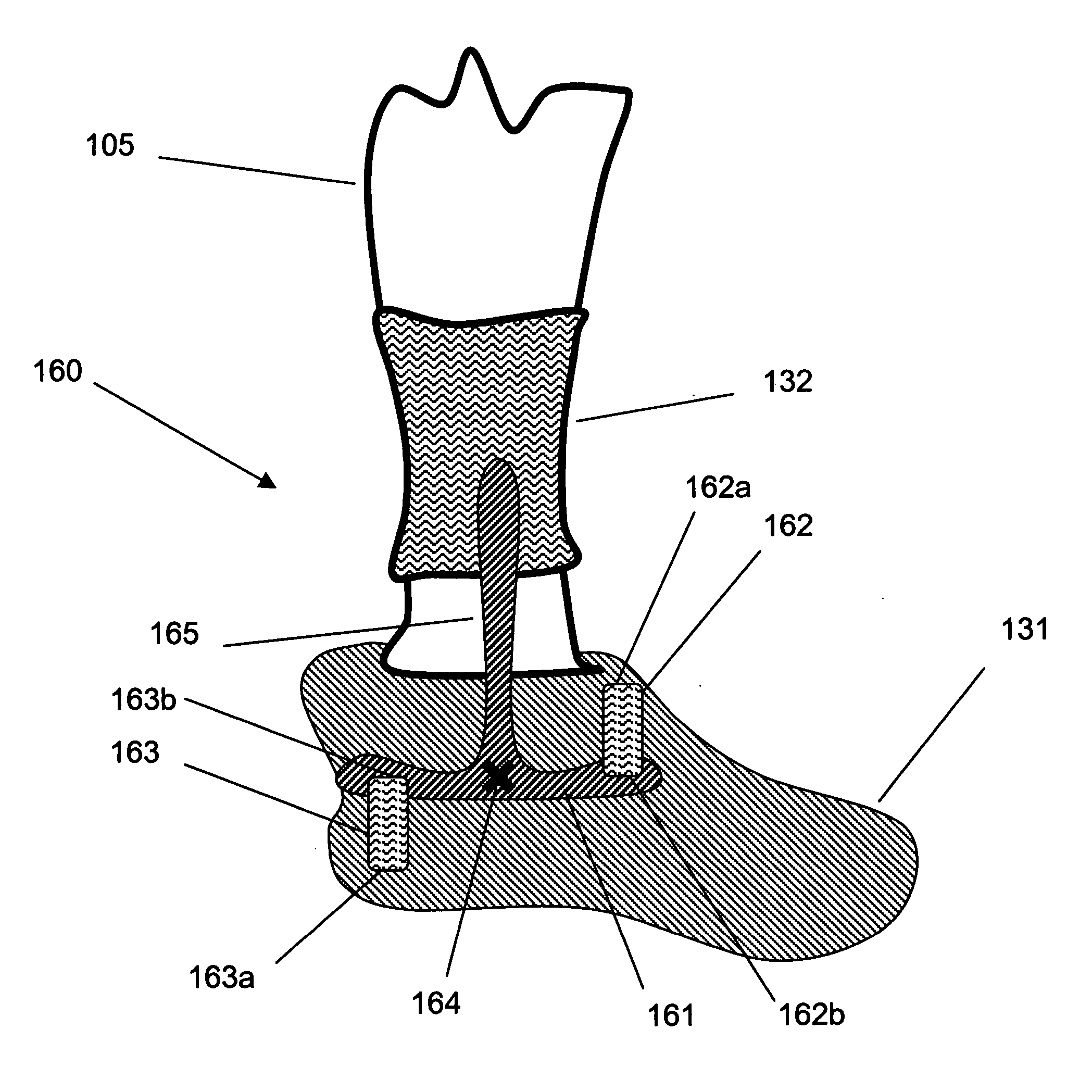 Methods and devices for reducing stance energy for rehabilitation and to enhance physical performance