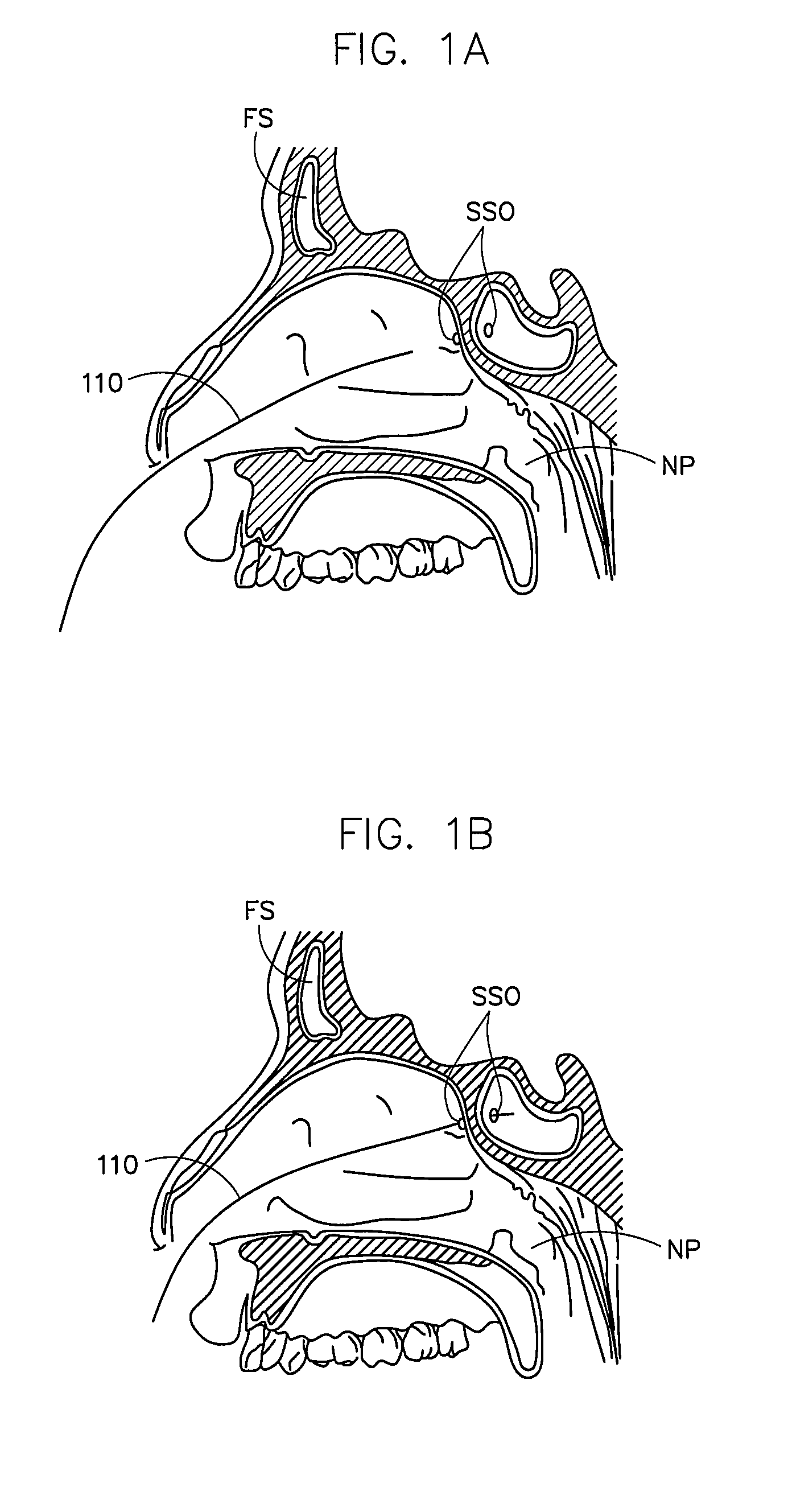 Corewire design and construction for medical devices