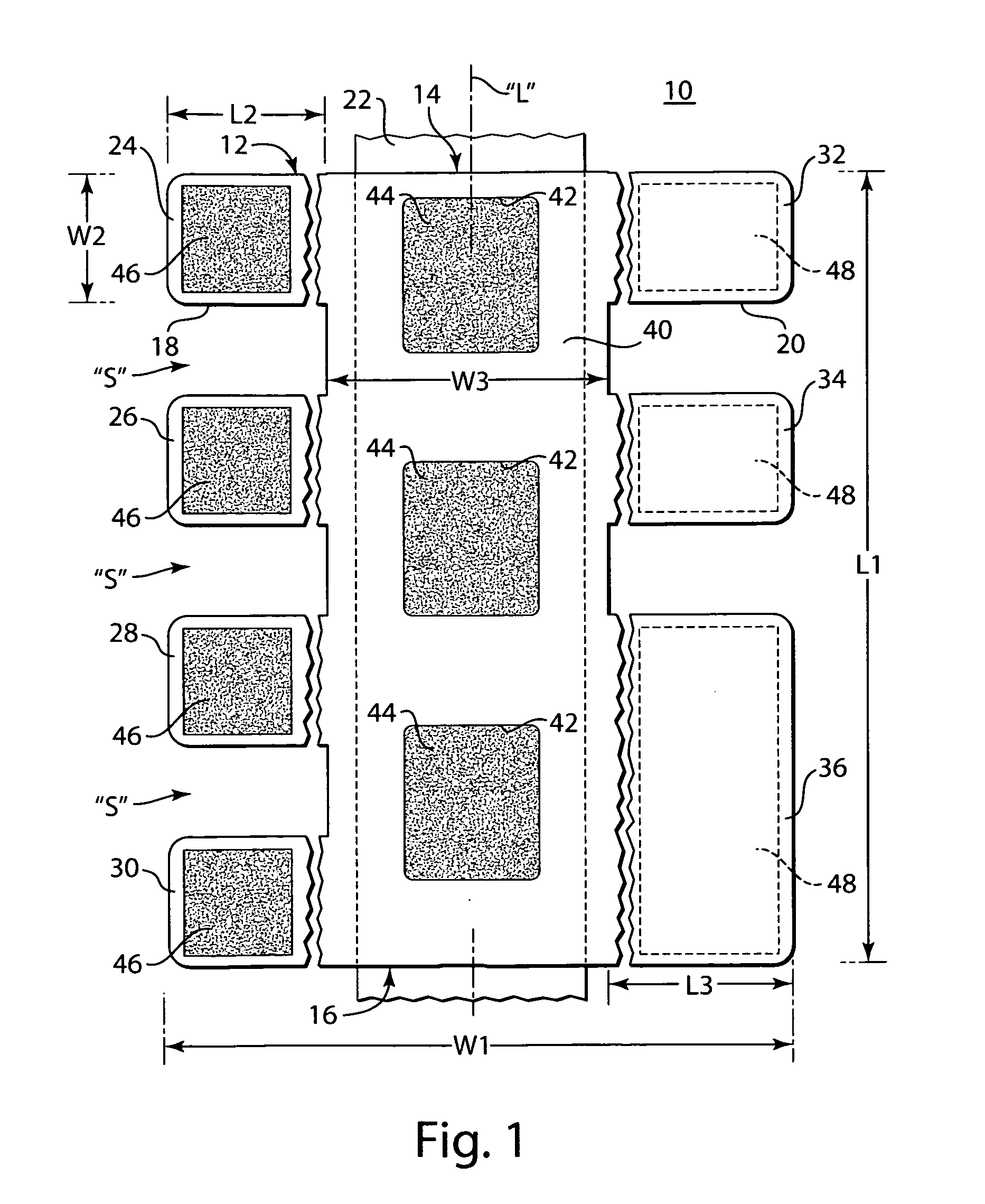 Arm board patient securement arrangement