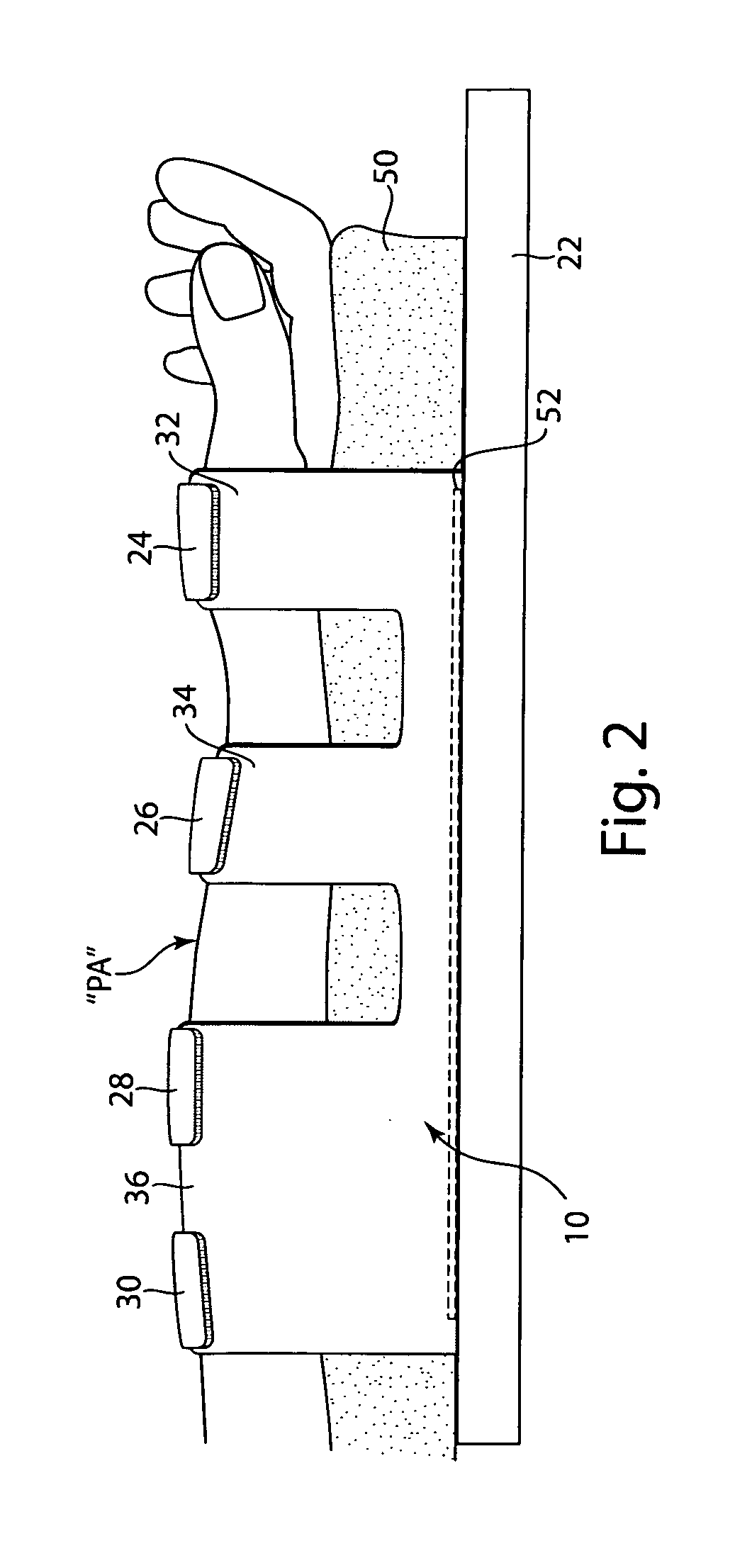 Arm board patient securement arrangement