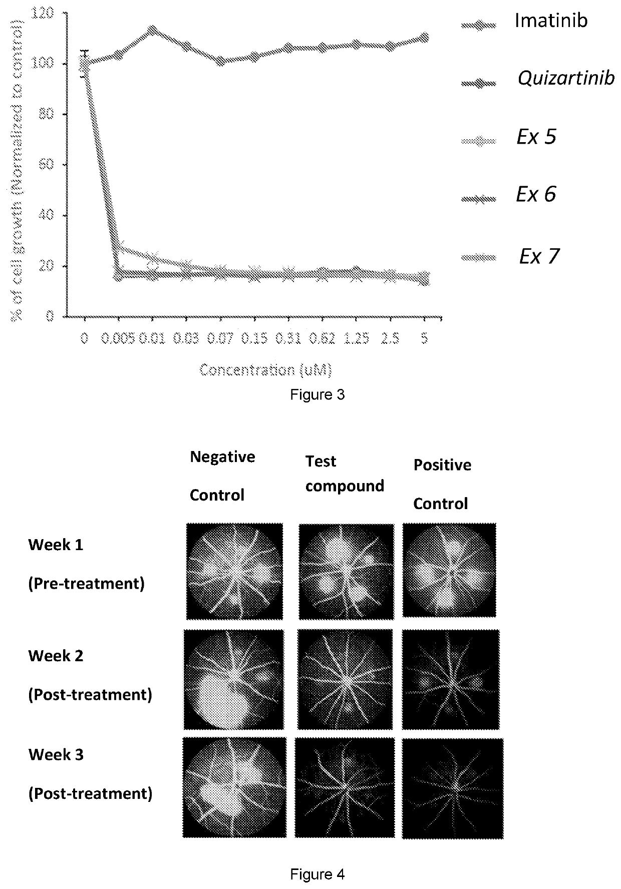 Compounds for treatment of eye disorders