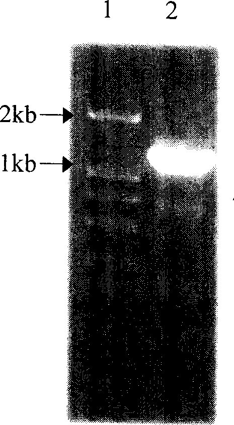 Medlar carotenoid synthase gene PSY and plasmid comprising the gene