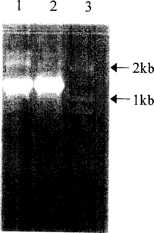 Medlar carotenoid synthase gene PSY and plasmid comprising the gene