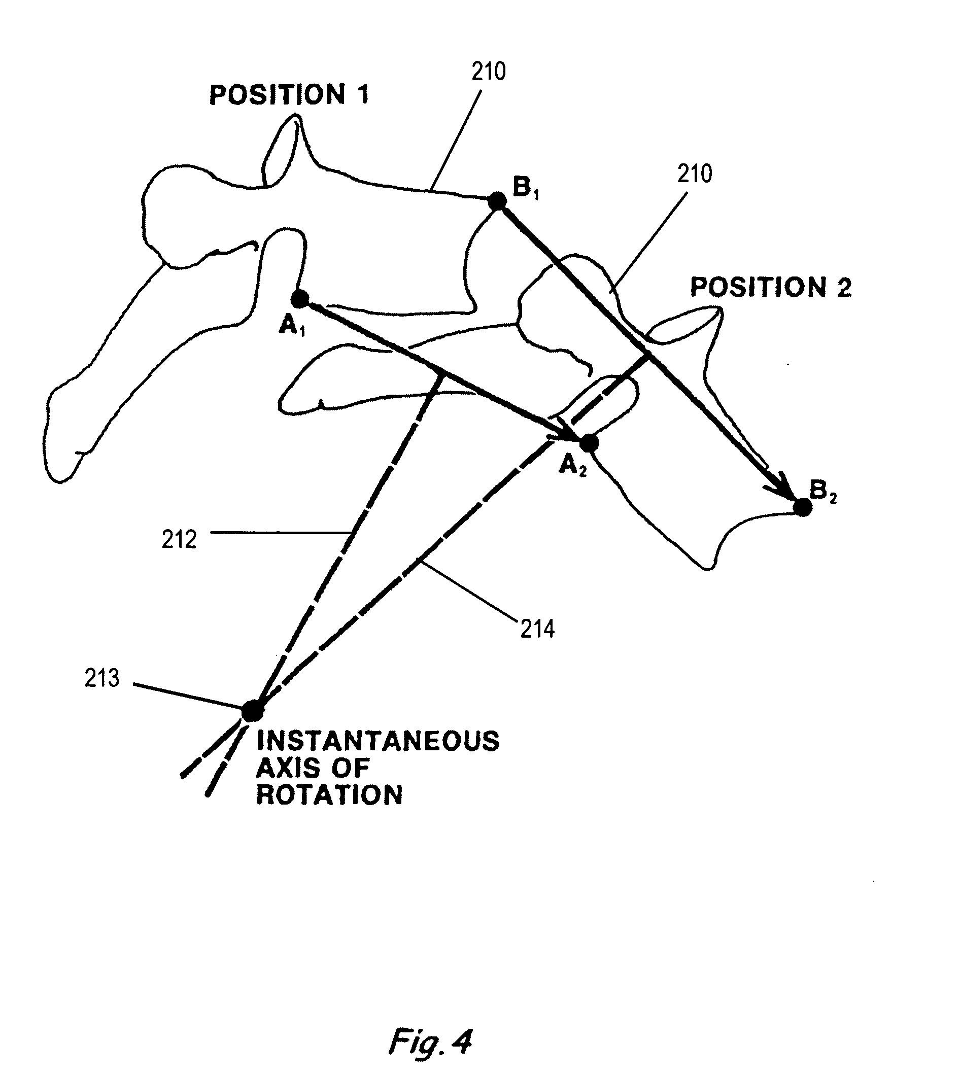 Intervertebral disc replacement prosthesis