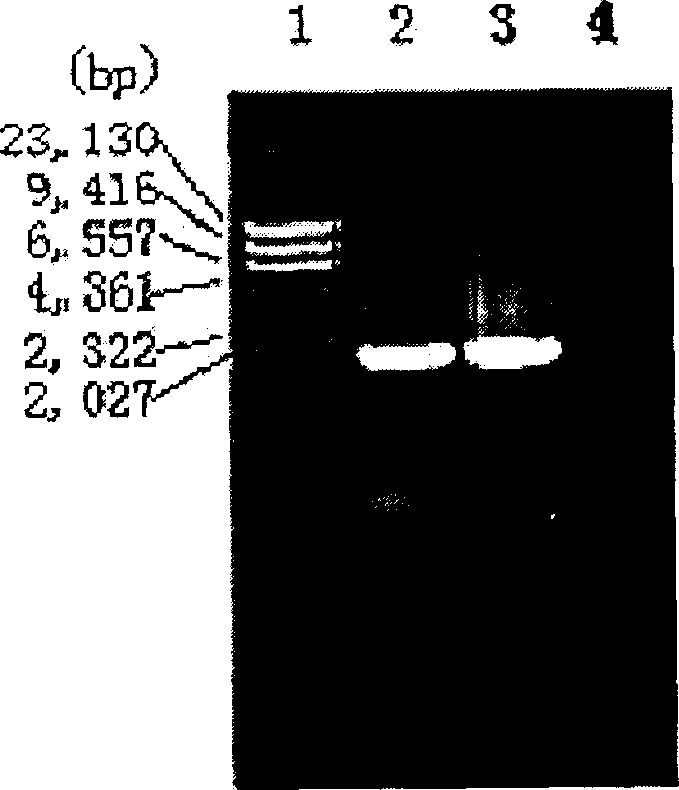 Foot-and-mouth disease virus resistant recombinant live bacteria and its preparation method