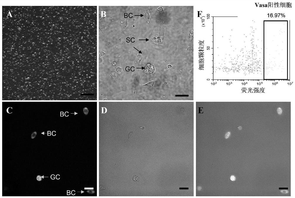 A spermatogonia separation liquid and its application in the separation and purification of spermatogonia