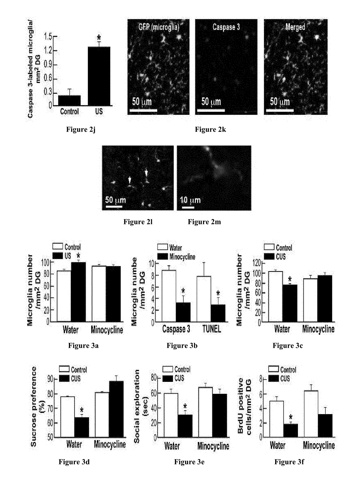 Treatment of mood and stress related disorders