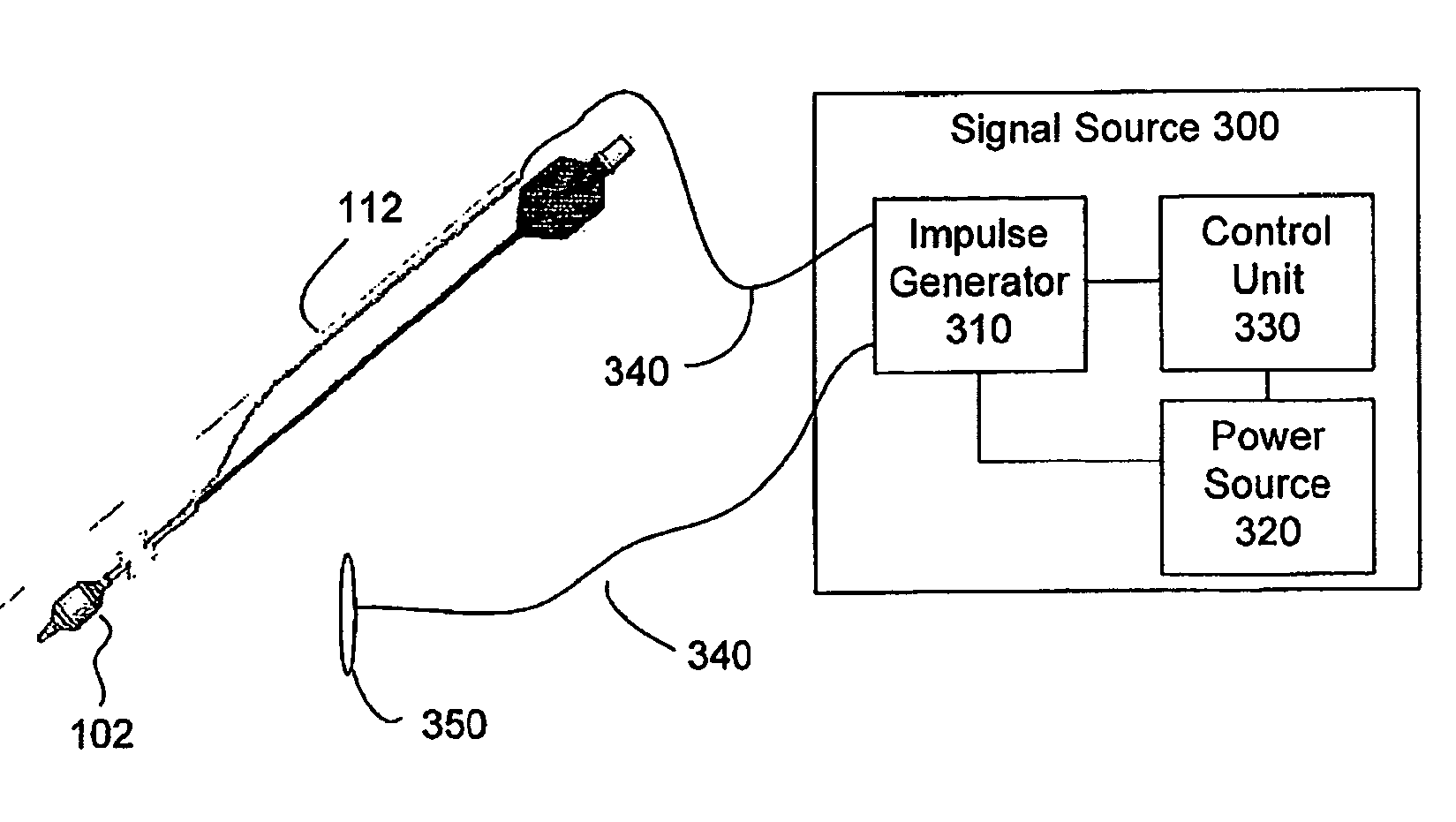 Methods and apparatus for deep brain stimulation