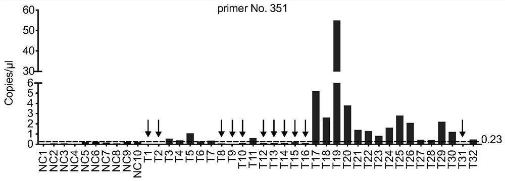 Amplification primer for detecting echinococcosis through ddPCR and construction method and application of amplification primer