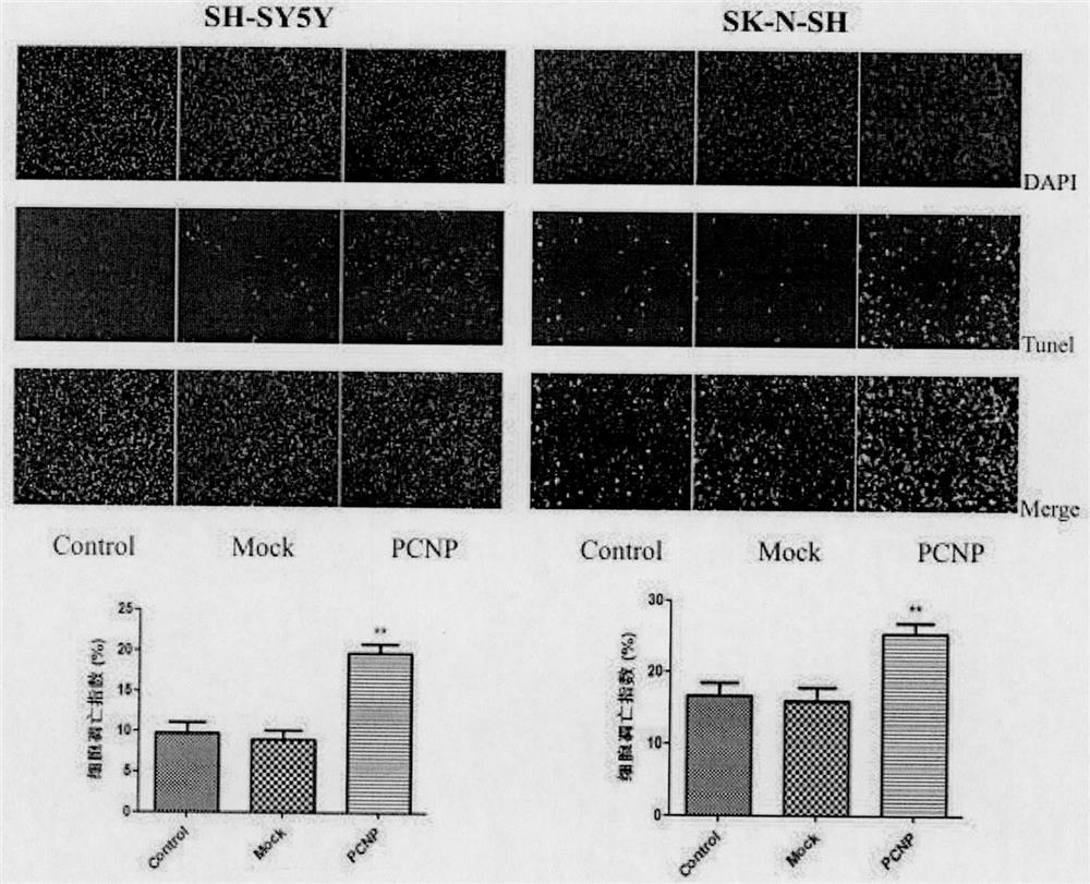 Preparation and application of a drug for overexpressing PCNP gene