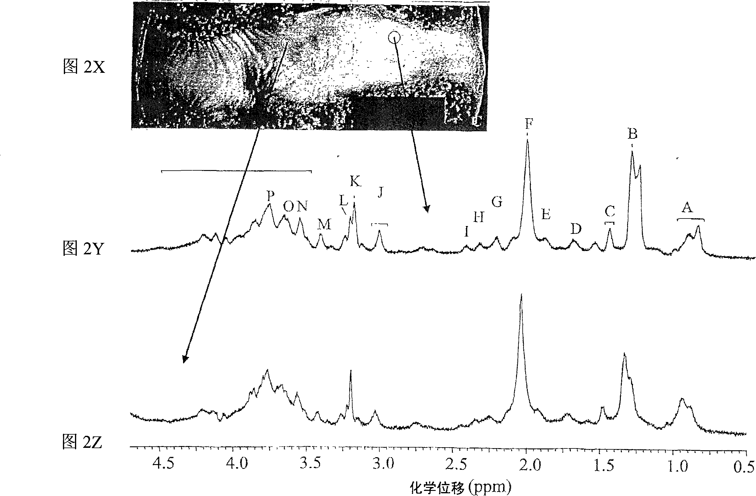 Systems and methods using nuclear magnetic resonance (NMR) spectroscopy to evaluate pain and degenerative properties of tissue