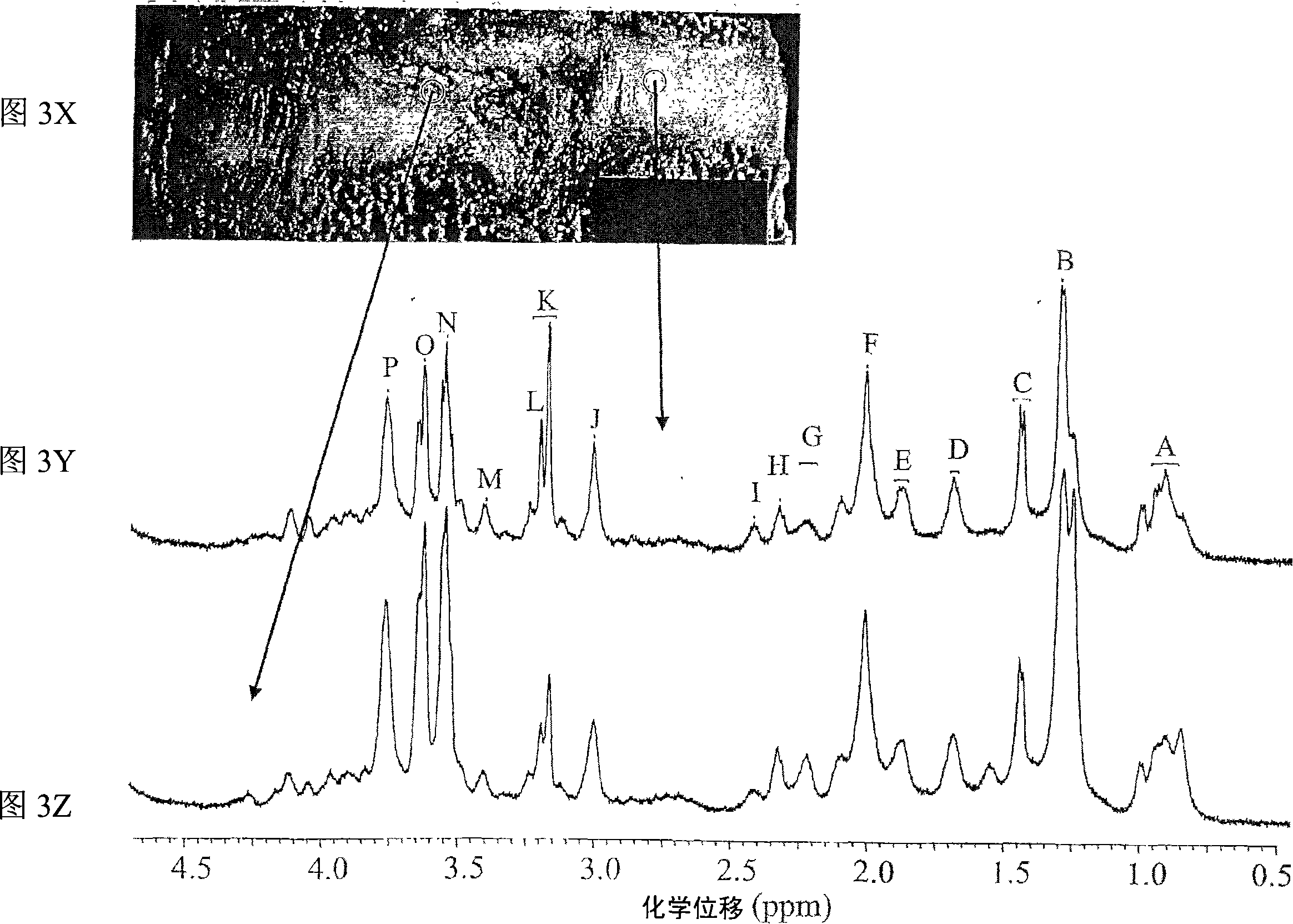 Systems and methods using nuclear magnetic resonance (NMR) spectroscopy to evaluate pain and degenerative properties of tissue